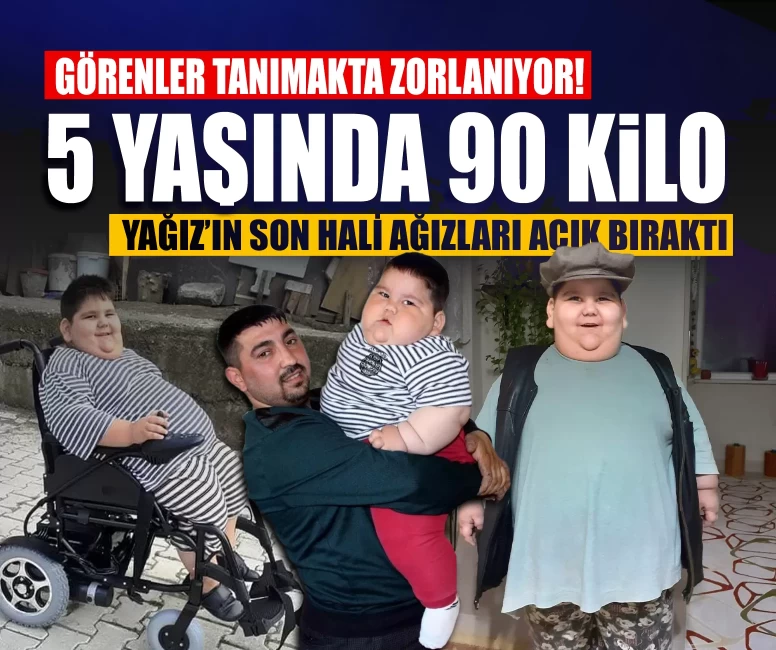 Görenler tanımakta zorlanıyor! 5 yaşında 90 kilo olan Yağız’ın son hali ağızları açık bıraktı