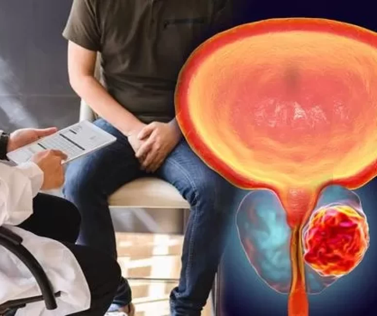 Prostat kanserinde erken tanı için uzmanlardan uyarı