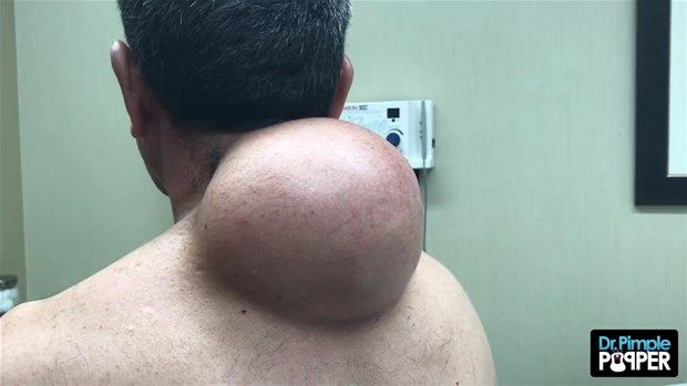 Boynundan çıkan şey mide bulandırdı! İnanılmaz... 2