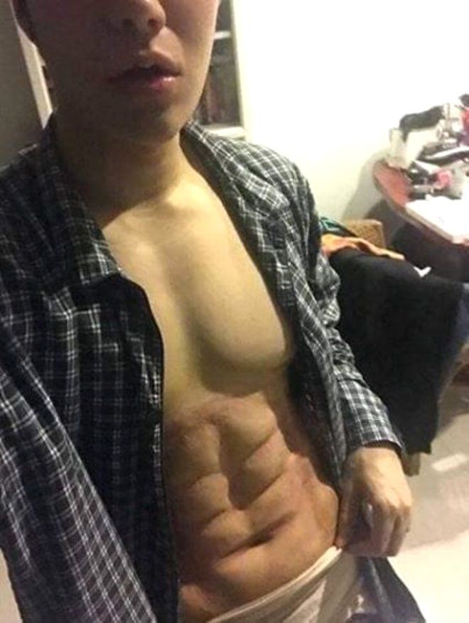 Bu operasyonu duyan erkekler hastaneye koşuyor 1