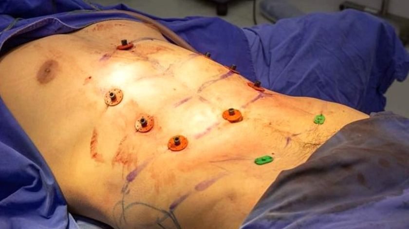 Bu operasyonu duyan erkekler hastaneye koşuyor 3