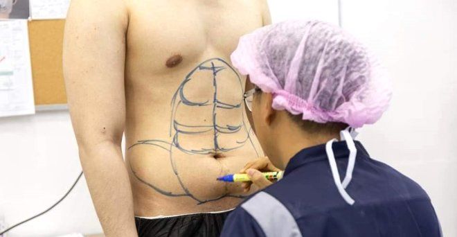 Bu operasyonu duyan erkekler hastaneye koşuyor 4