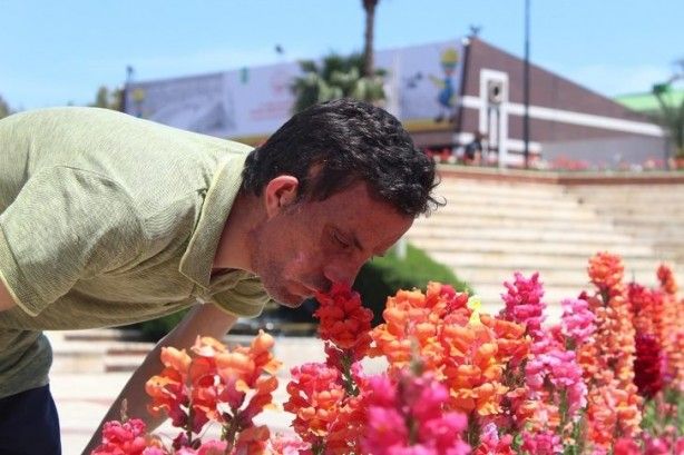 7,5 yıl önce yüz nakli olmuştu! İşte son hali 6