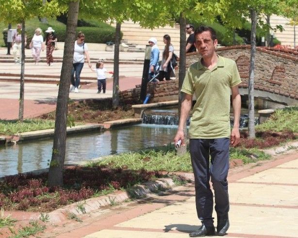 7,5 yıl önce yüz nakli olmuştu! İşte son hali 3