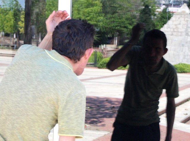 7,5 yıl önce yüz nakli olmuştu! İşte son hali 11