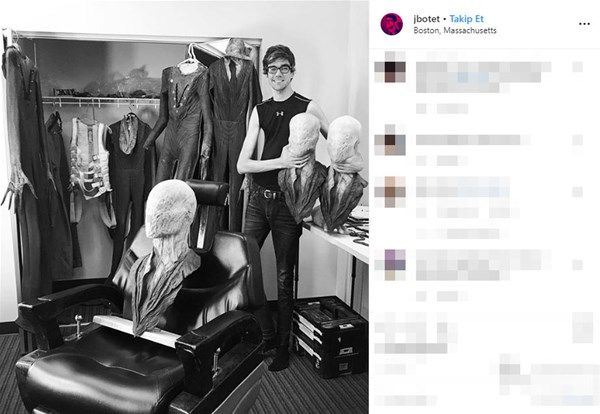 Hastalığı sayesinde ünlü oldu 4