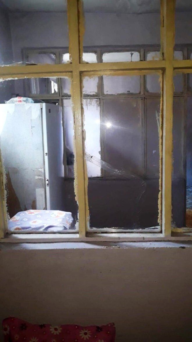 Bayılıp kolu kırılan öğrencisinin evine gidince gözlerine inanamadı! 3