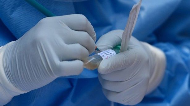 Türk profesörden heyecanlandıran aşısı çıkışı 11