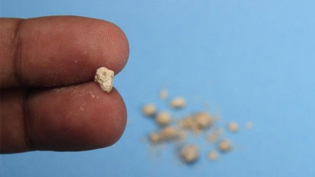 Hayati uyarı! Su içmezseniz... 2