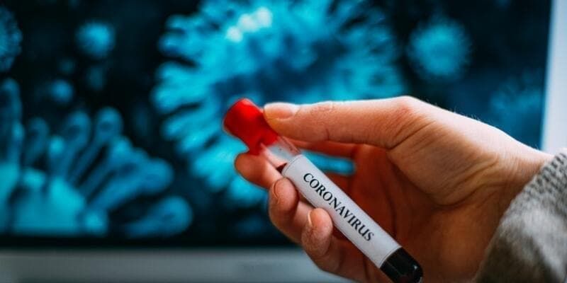 Sağlık Bakanlığı illere ve yaşa göre Kovid-19 verilerini paylaştı! 8