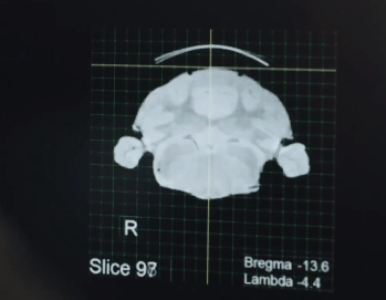 B planı devrede! Daha büyük riskler olabilir... 14