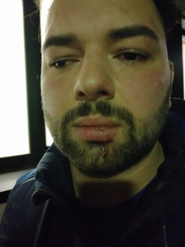 Almanya'da polisler Türk iş insanını darp etti 2