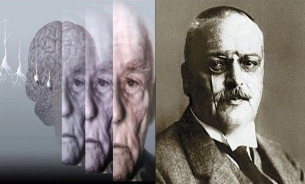 'Kanser' ismi nereden geliyor? 1