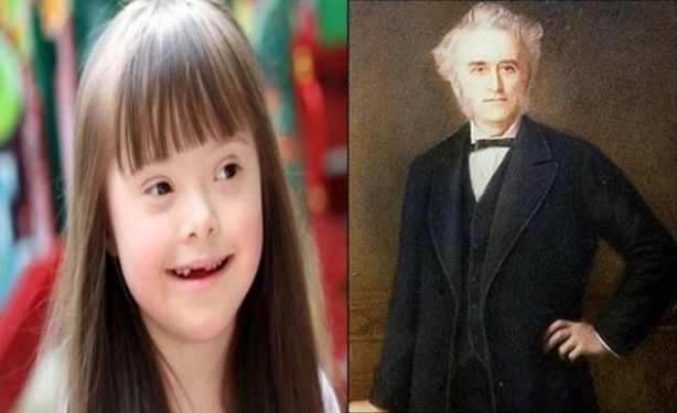 'Kanser' ismi nereden geliyor? 4