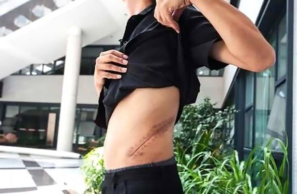 iPhone için böbreğini satan gençten kötü haber 1