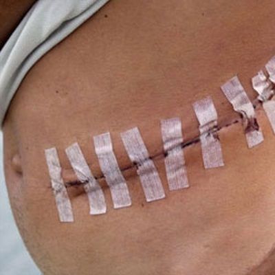 iPhone için böbreğini satan gençten kötü haber 2