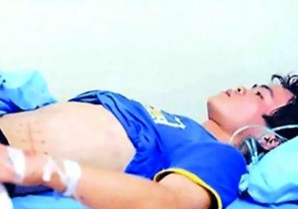 iPhone için böbreğini satan gençten kötü haber 5