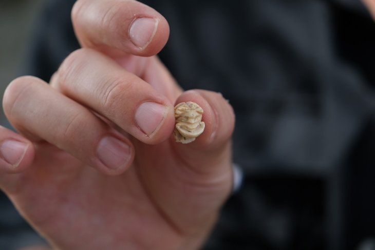 Çukurdan çıkanlar şoke etti! 13