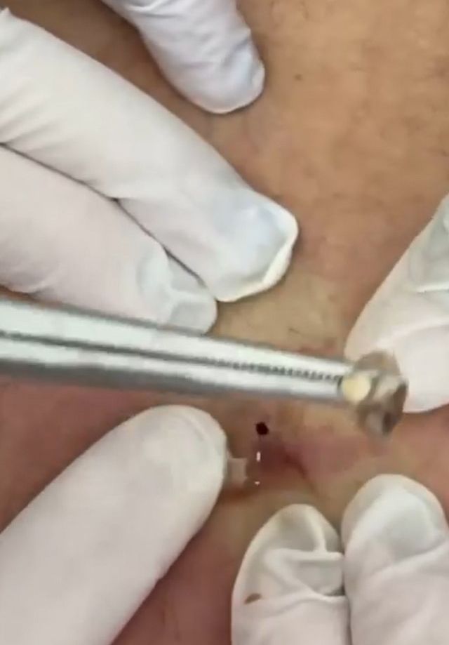 Sivilce şikayetiyle gitti, gerçeği öğrenince şok oldu! 14