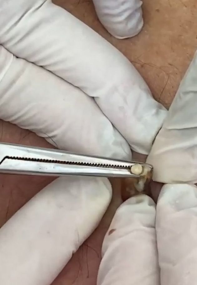 Sivilce şikayetiyle gitti, gerçeği öğrenince şok oldu! 11