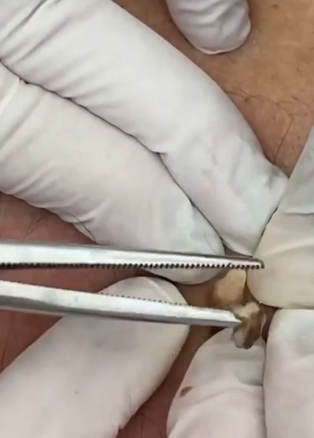 Sivilce şikayetiyle gitti, gerçeği öğrenince şok oldu! 12