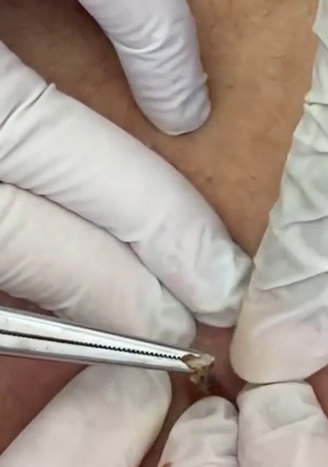 Sivilce şikayetiyle gitti, gerçeği öğrenince şok oldu! 10