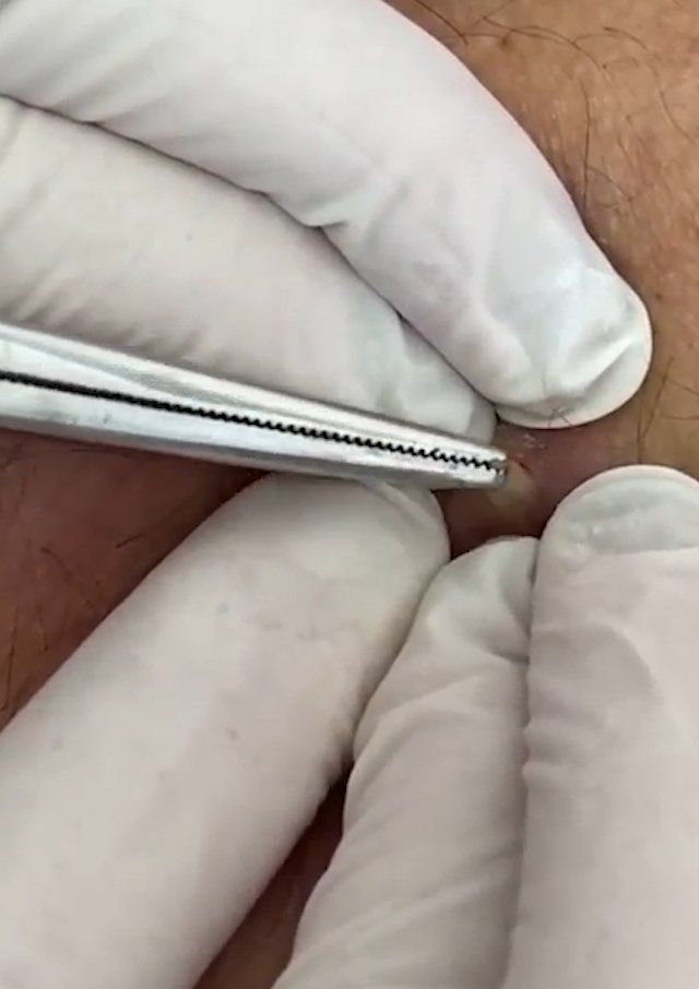 Sivilce şikayetiyle gitti, gerçeği öğrenince şok oldu! 7