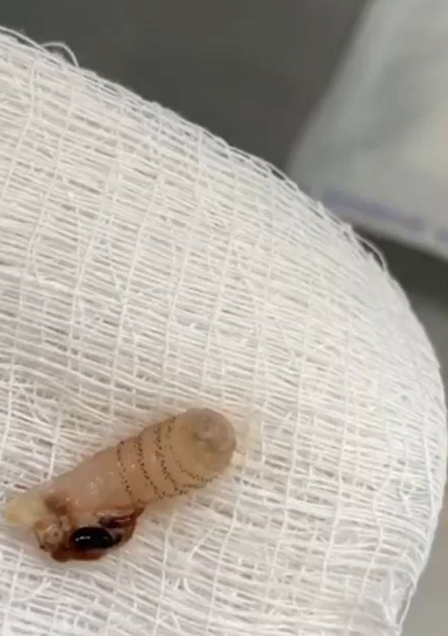 Sivilce şikayetiyle gitti, gerçeği öğrenince şok oldu! 18