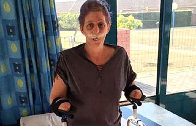 Bir ısırıkla hayatı kabusa döndü! 5