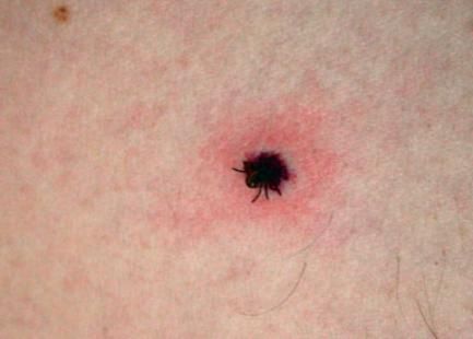 Kene popülasyonunda endişe verici artış! 6