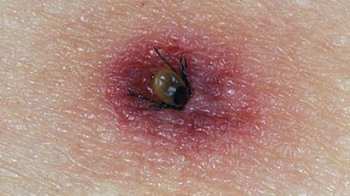 Kene popülasyonunda endişe verici artış! 7