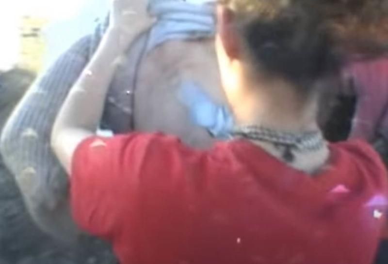 Sivilce zannetti ama gerçek dehşete düşürdü! 4