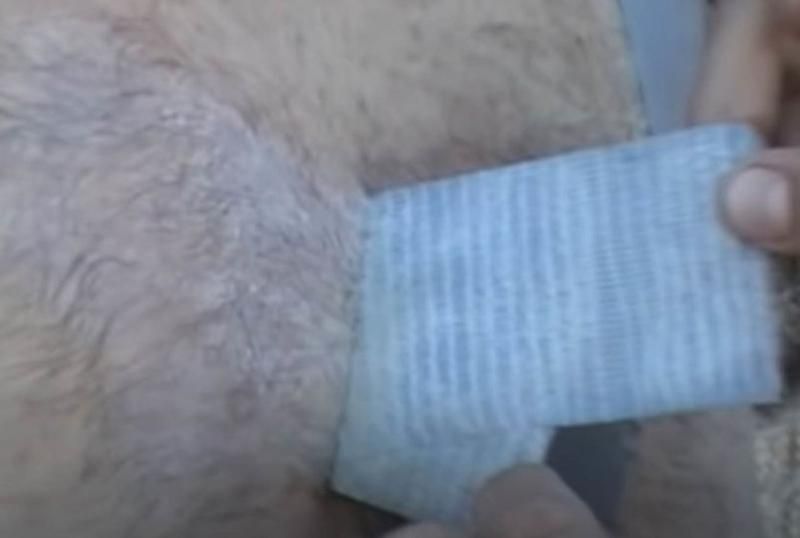 Sivilce zannetti ama gerçek dehşete düşürdü! 9