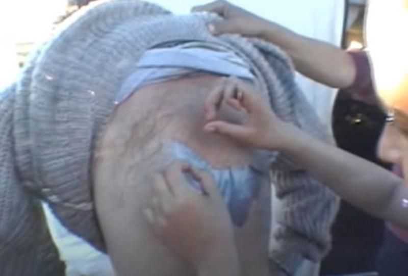 Sivilce zannetti ama gerçek dehşete düşürdü! 7