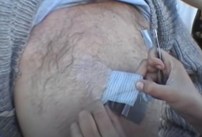 Sivilce zannetti ama gerçek dehşete düşürdü! 8