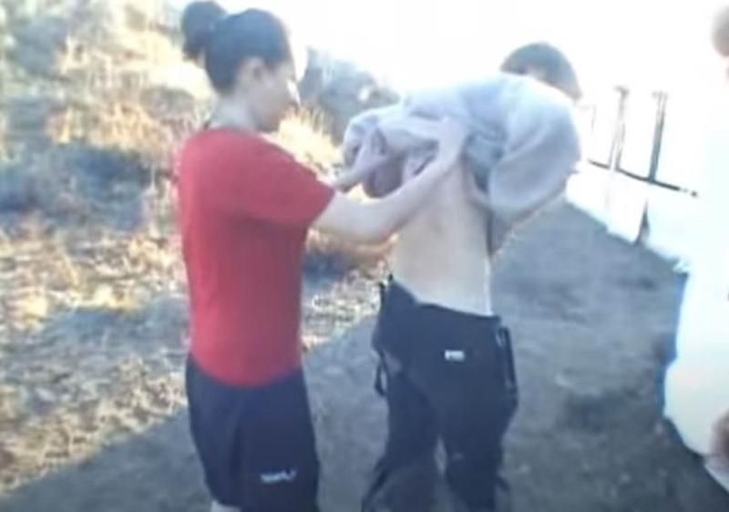 Sivilce zannetti ama gerçek dehşete düşürdü! 48