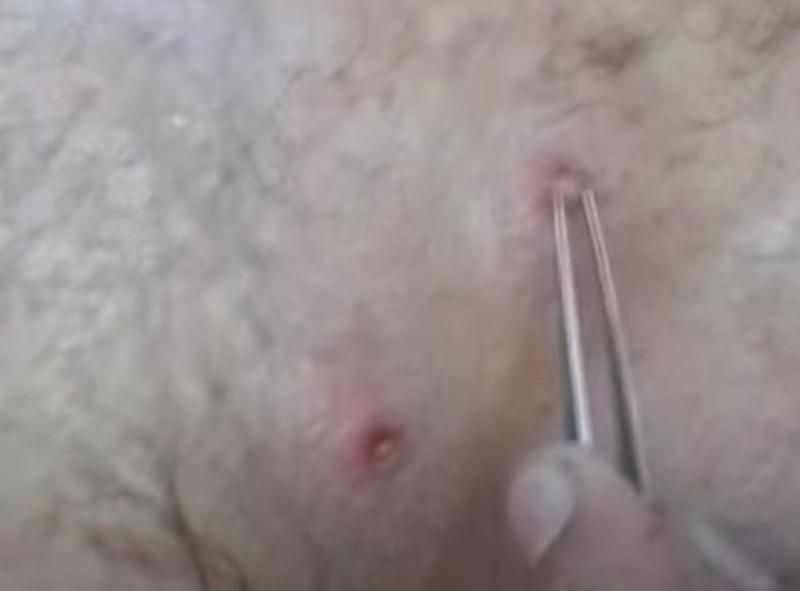 Sivilce zannetti ama gerçek dehşete düşürdü! 49