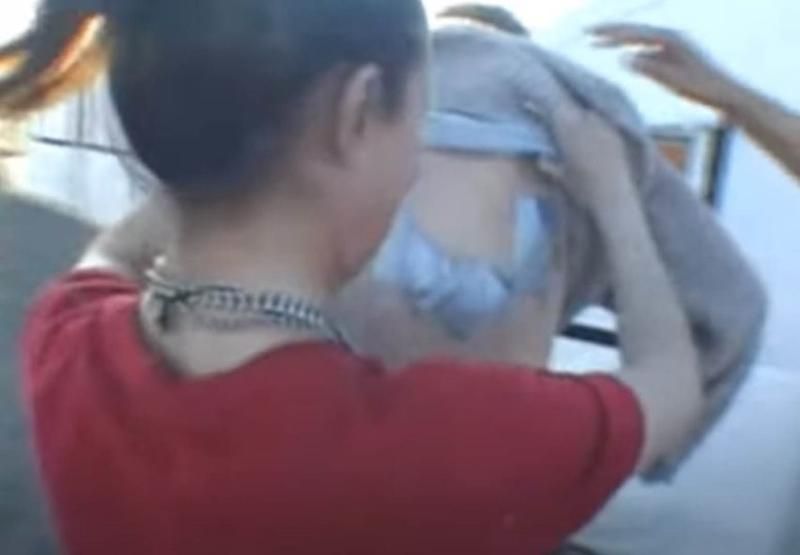 Sivilce zannetti ama gerçek dehşete düşürdü! 2