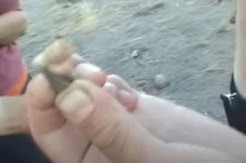 Sivilce zannetti ama gerçek dehşete düşürdü! 65