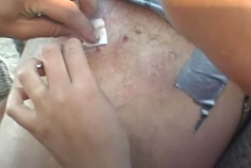 Sivilce zannetti ama gerçek dehşete düşürdü! 31