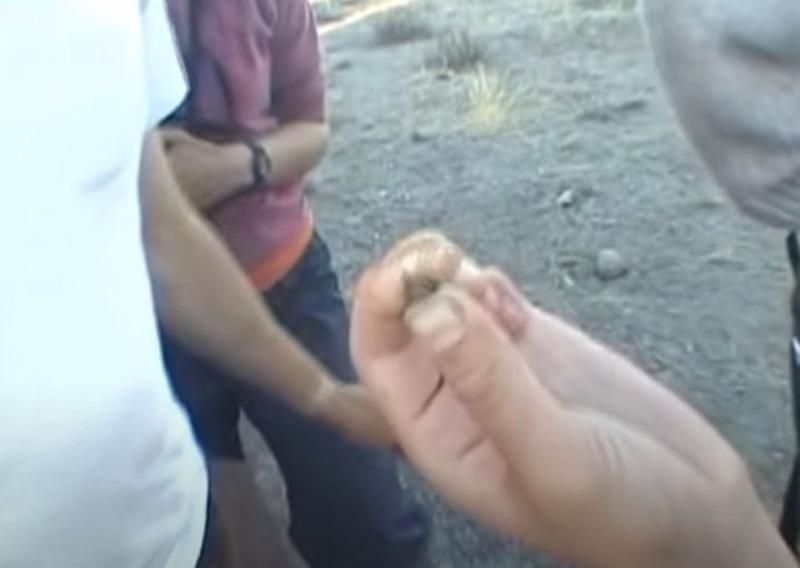 Sivilce zannetti ama gerçek dehşete düşürdü! 34