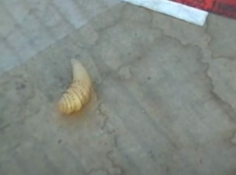 Sivilce zannetti ama gerçek dehşete düşürdü! 39