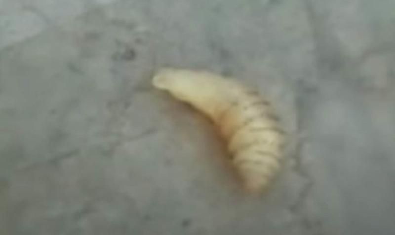 Sivilce zannetti ama gerçek dehşete düşürdü! 40