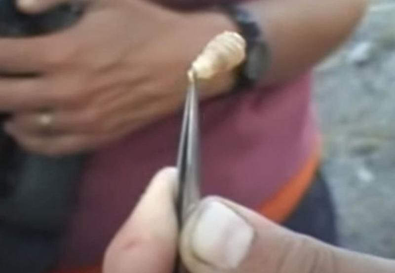 Sivilce zannetti ama gerçek dehşete düşürdü! 42