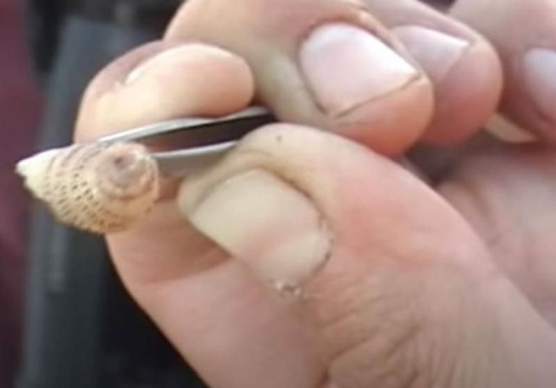 Sivilce zannetti ama gerçek dehşete düşürdü! 43