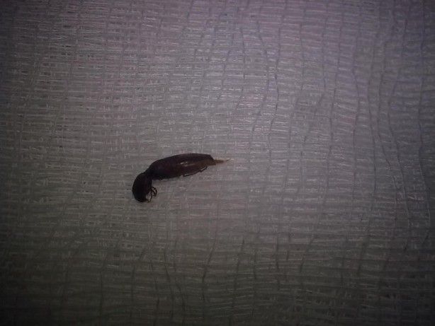 Kulaktan çıkanlar görenleri şoke etti! 4