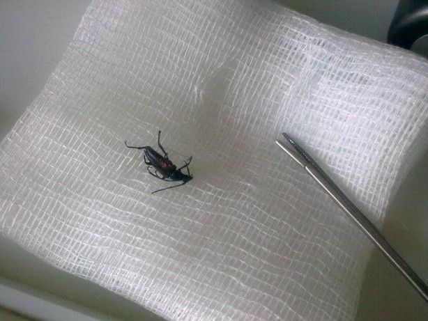 Kulaktan çıkanlar görenleri şoke etti! 5