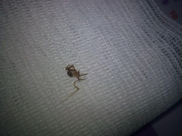 Kulaktan çıkanlar görenleri şoke etti! 6