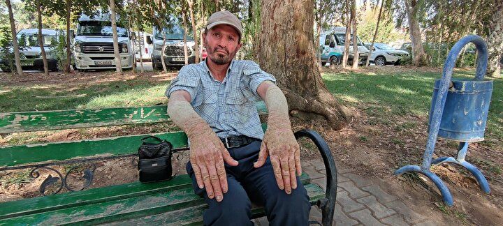 Hayatı kabusa döndü! Görenlerin kaçmasına alışamadı 1