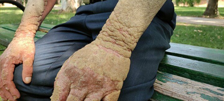 Hayatı kabusa döndü! Görenlerin kaçmasına alışamadı 4